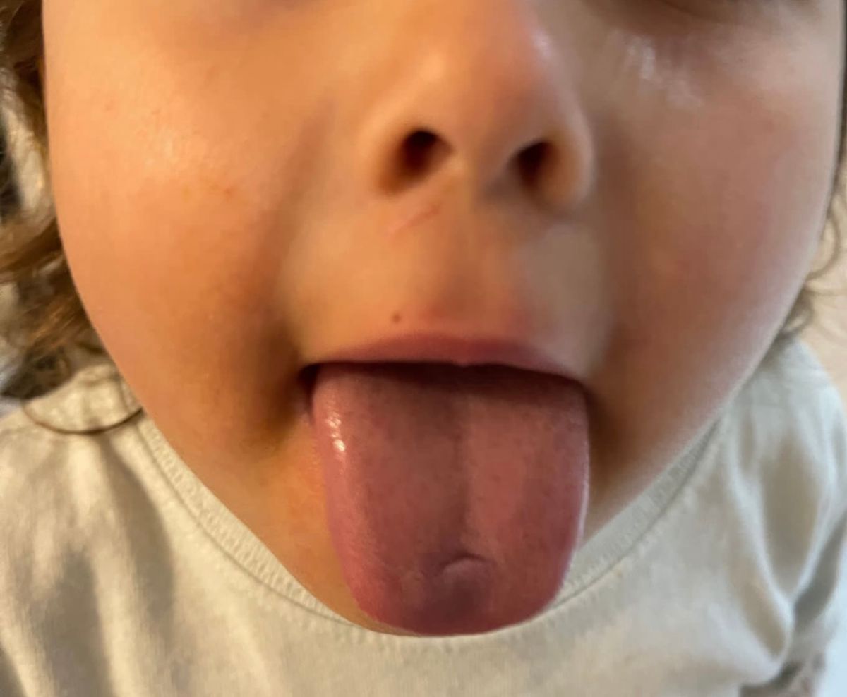 Lengua2