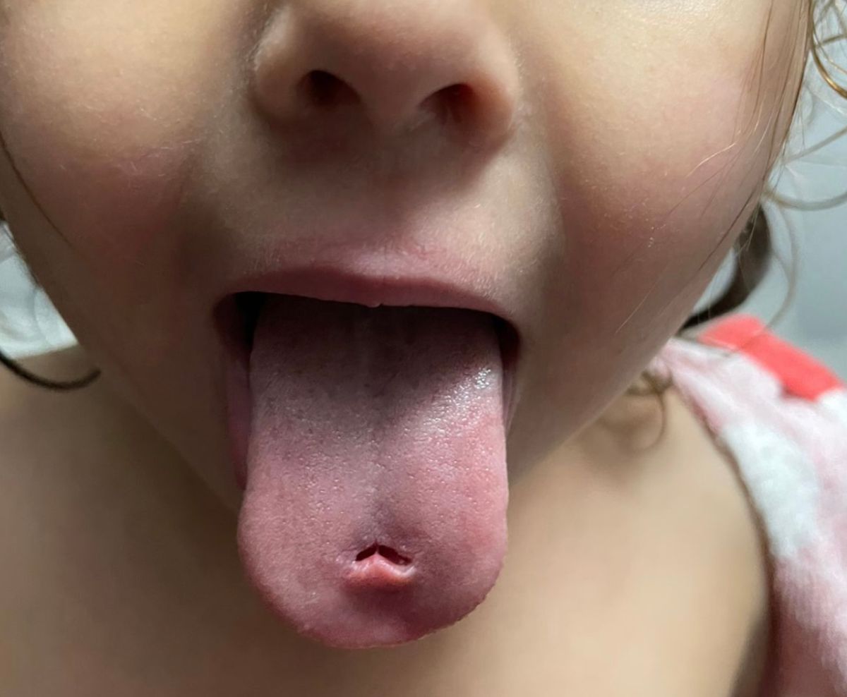 lengua1